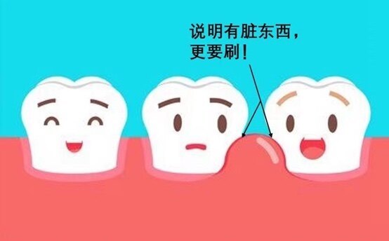 圖文圖片