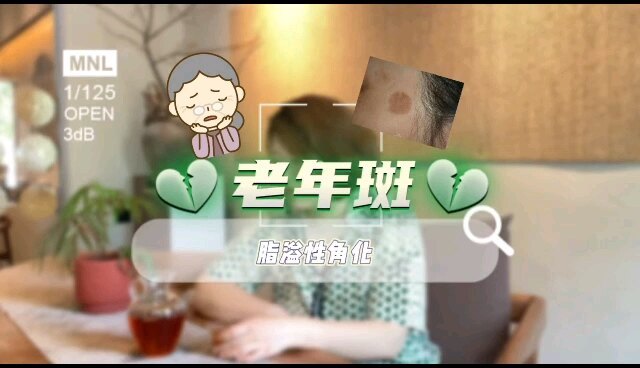 視頻封面