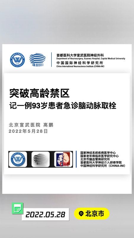 突破高龄禁区---记一例93岁急诊脑动脉取栓！