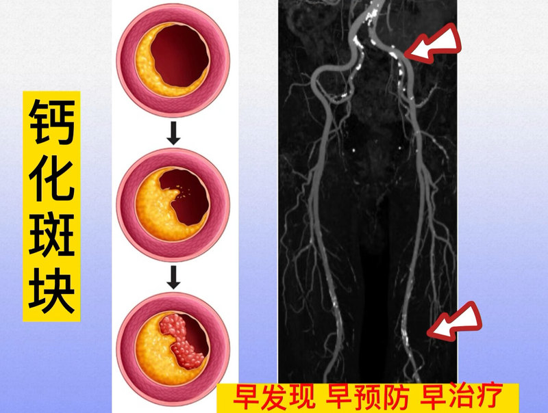 視頻封面