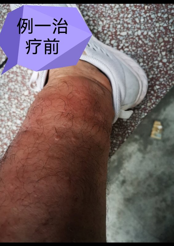 圖文圖片