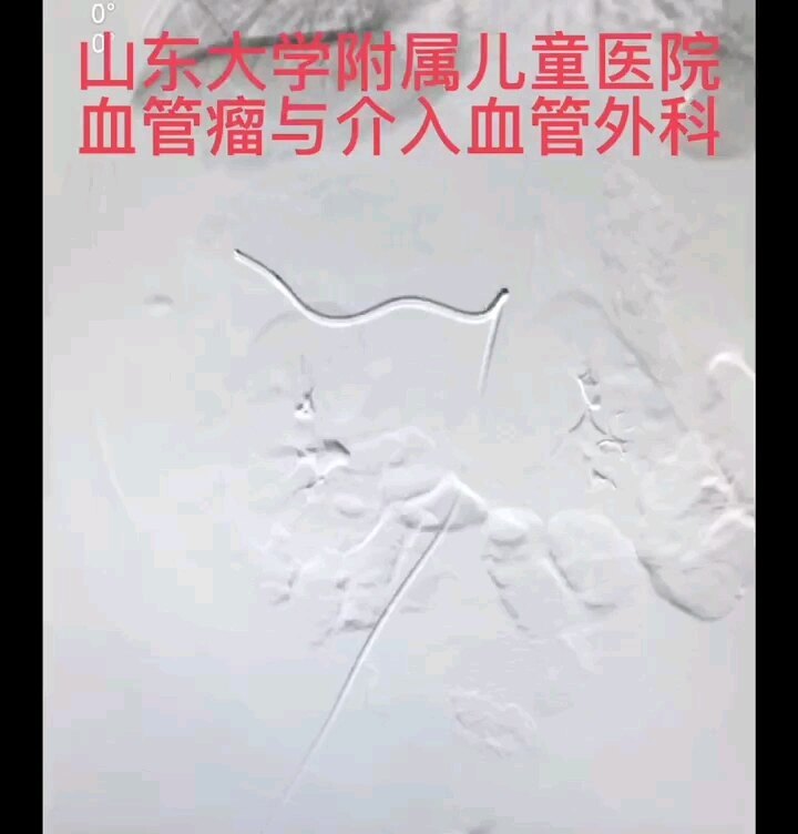 視頻封面