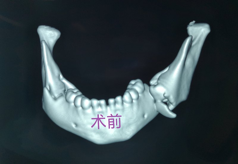 圖文圖片