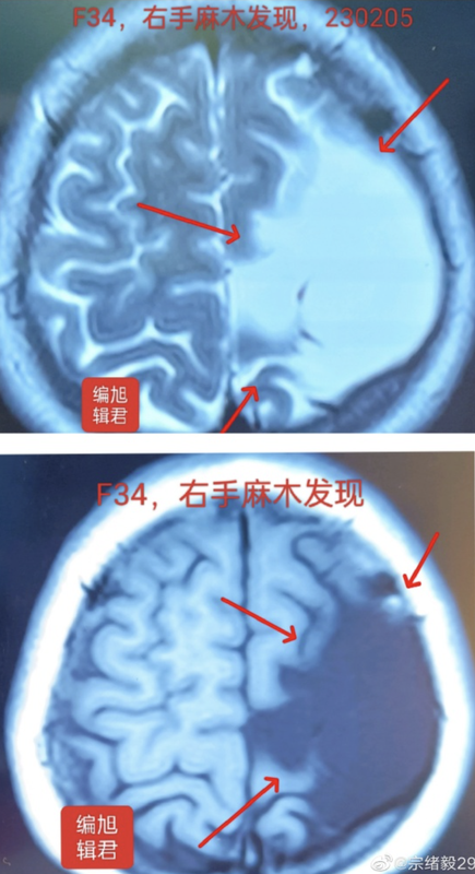 圖文圖片