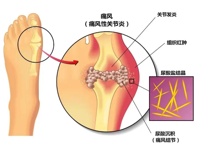 圖文圖片