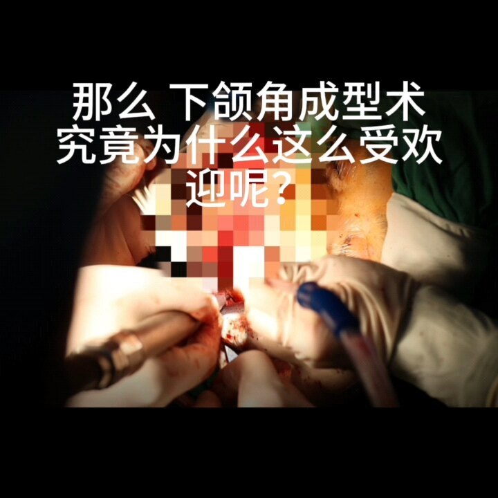 下颌角手术又称下颌角磨骨术