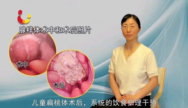 視頻封面