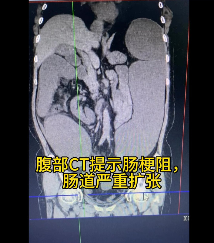 視頻封面