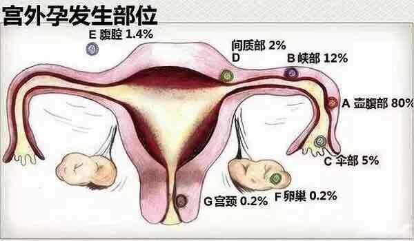 圖文圖片