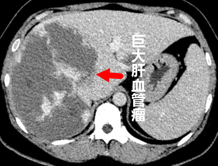 圖文圖片