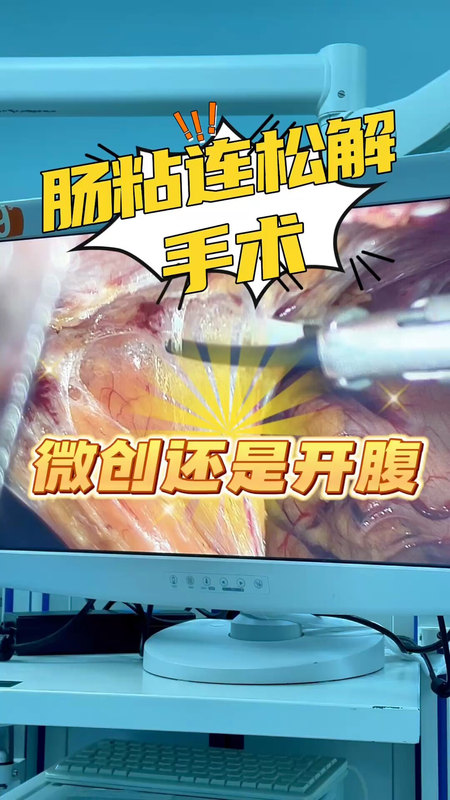 視頻封面