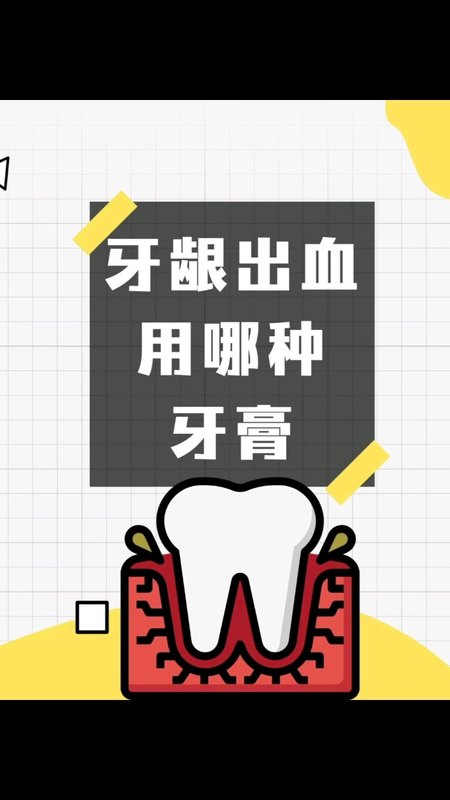 視頻封面