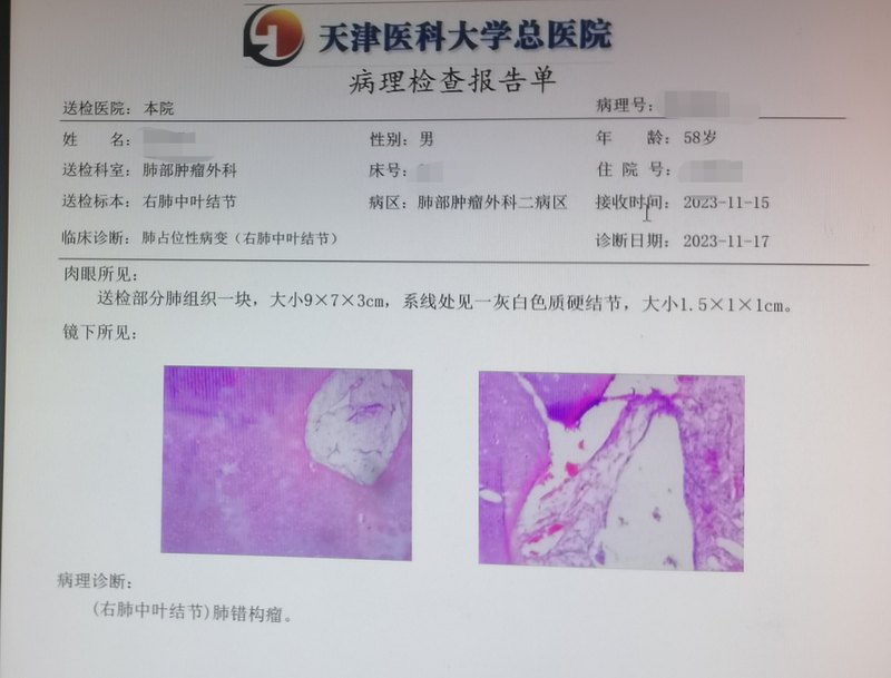 圖文圖片