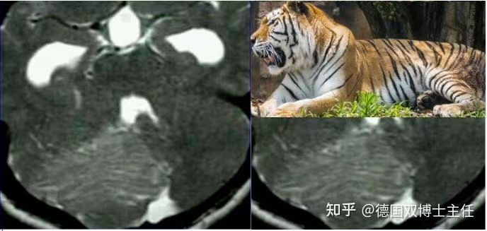 圖文圖片
