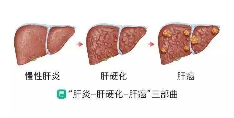 圖文圖片