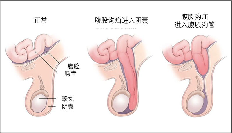 圖文圖片