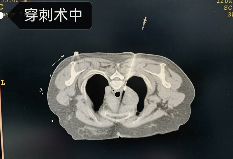 圖文圖片