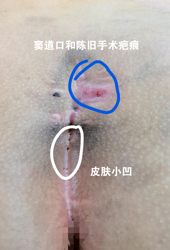圖文圖片