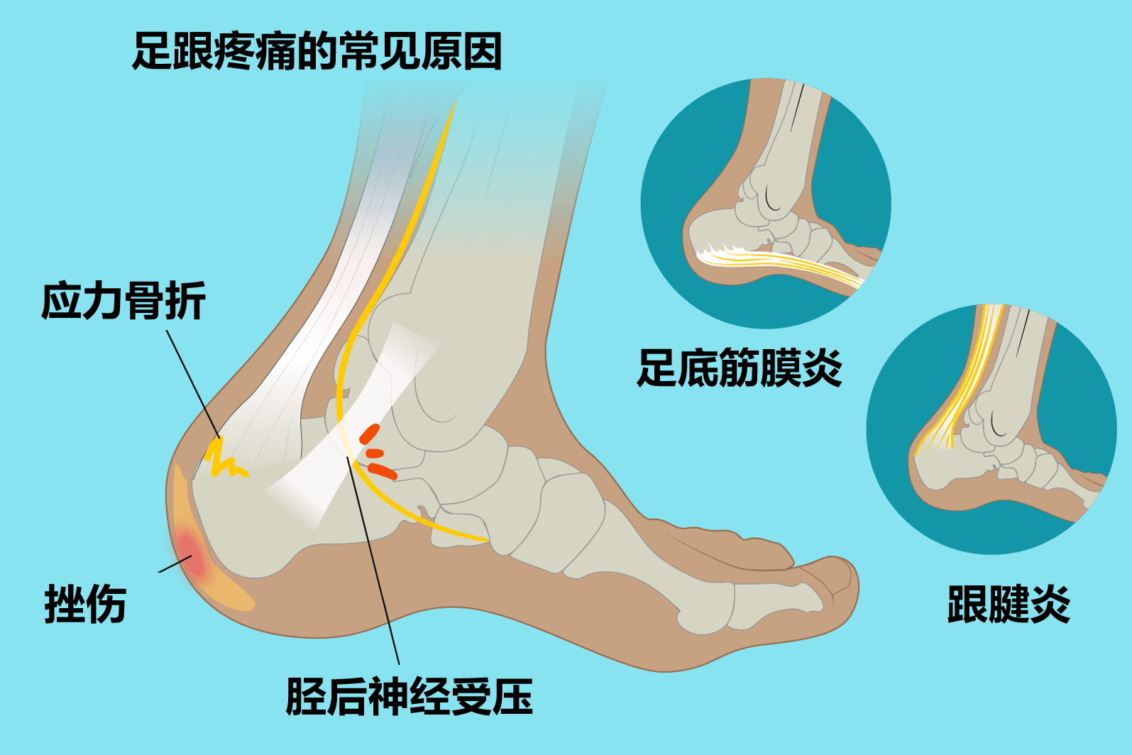 圖文圖片