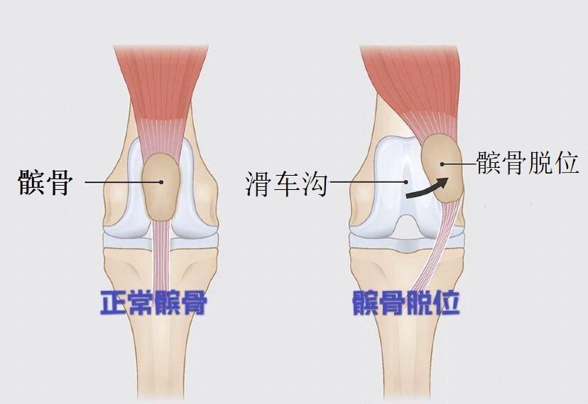 圖文圖片