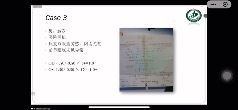 三棱镜（3）：垂直斜视视疲劳与三棱镜