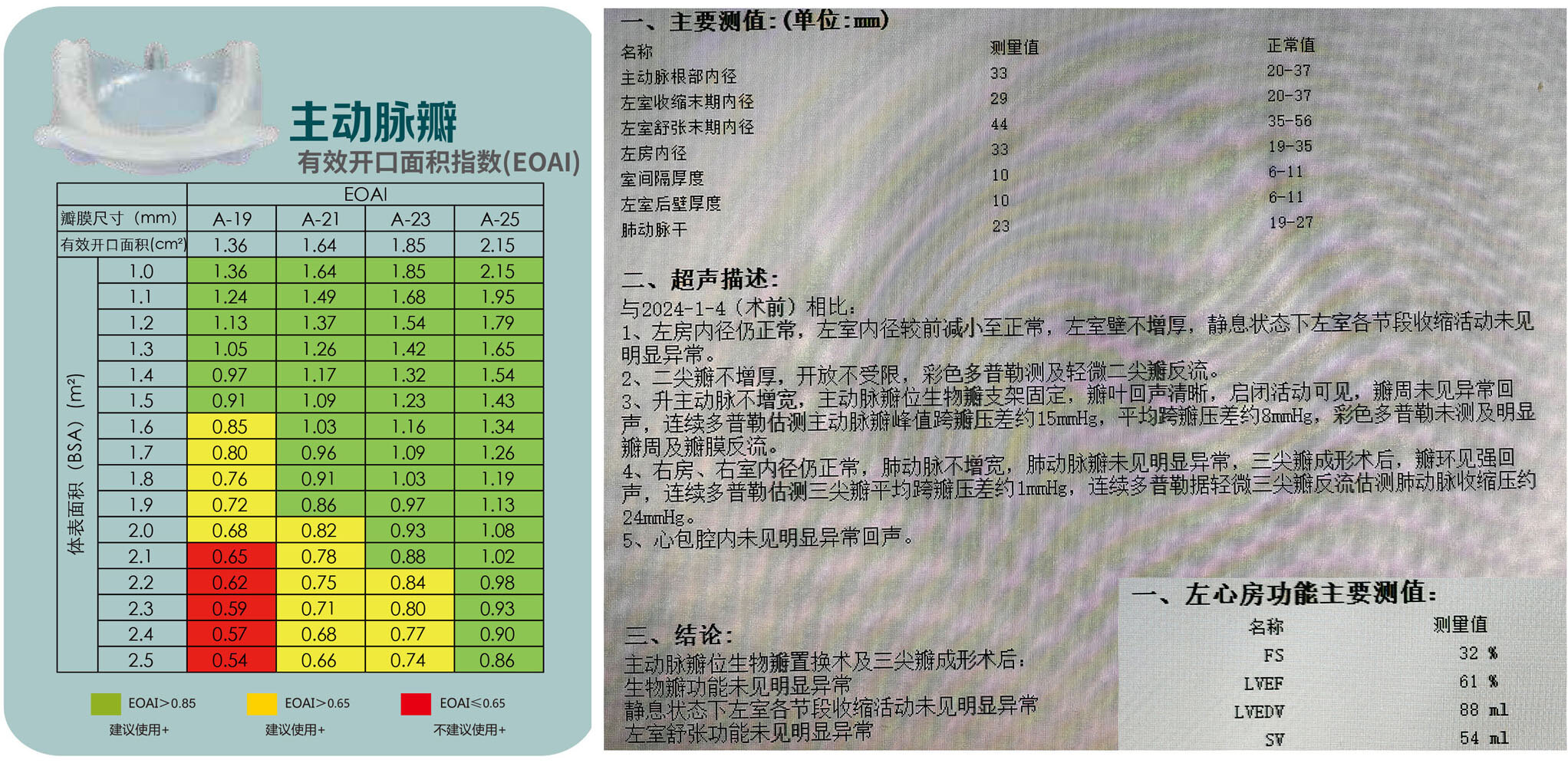 圖文圖片