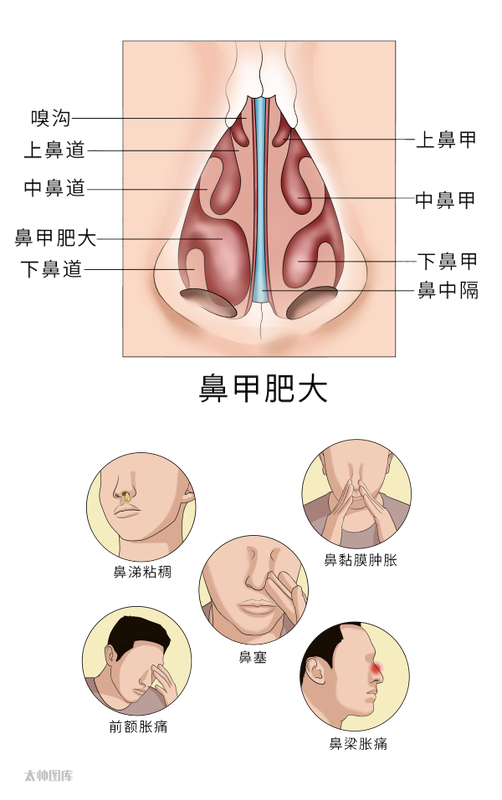 圖文圖片