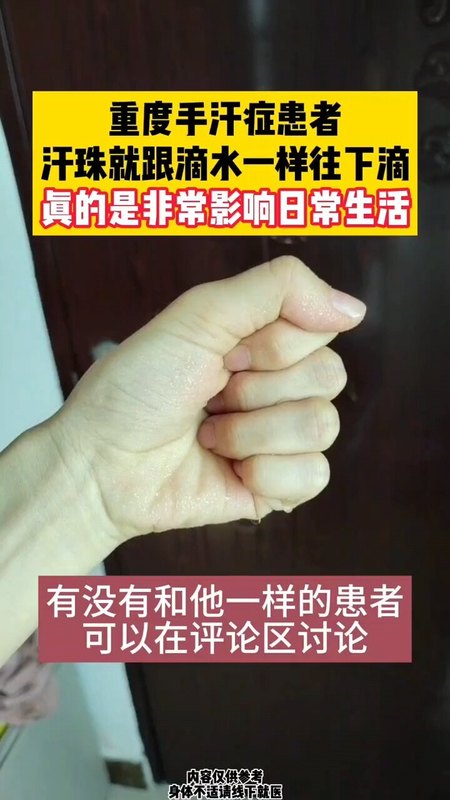 手汗多到可以滴下来！紧张、激动、压力大的时候容易出汗。特别是考试、开车、玩游戏的时候。