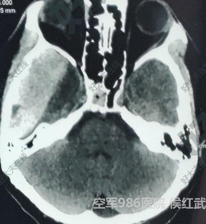 圖文圖片