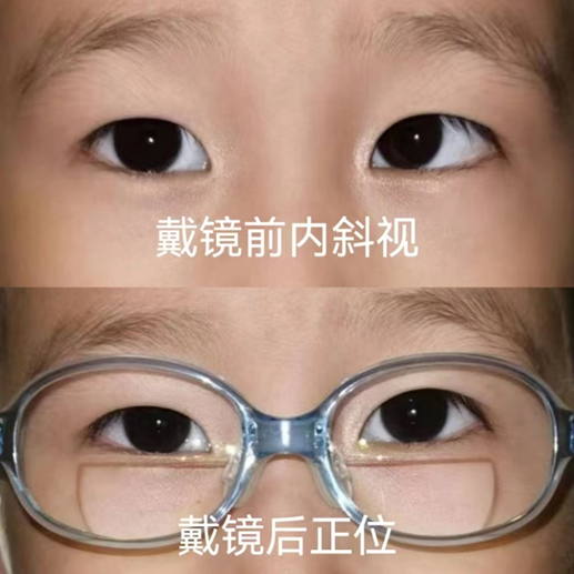 圖文圖片
