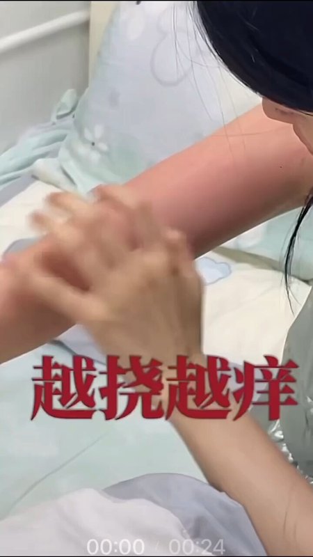 寻麻疹由什么引起的