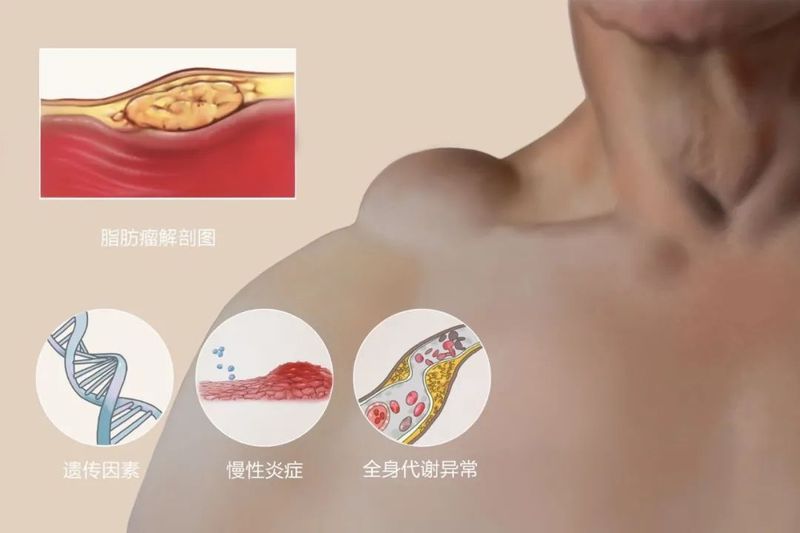 圖文圖片