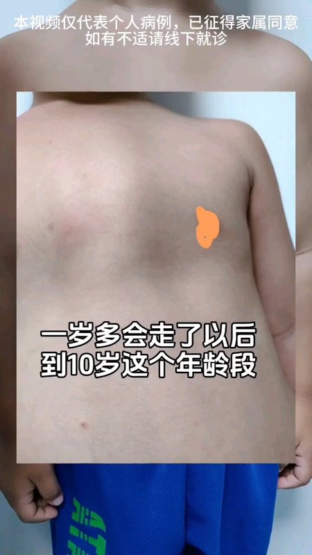 視頻封面