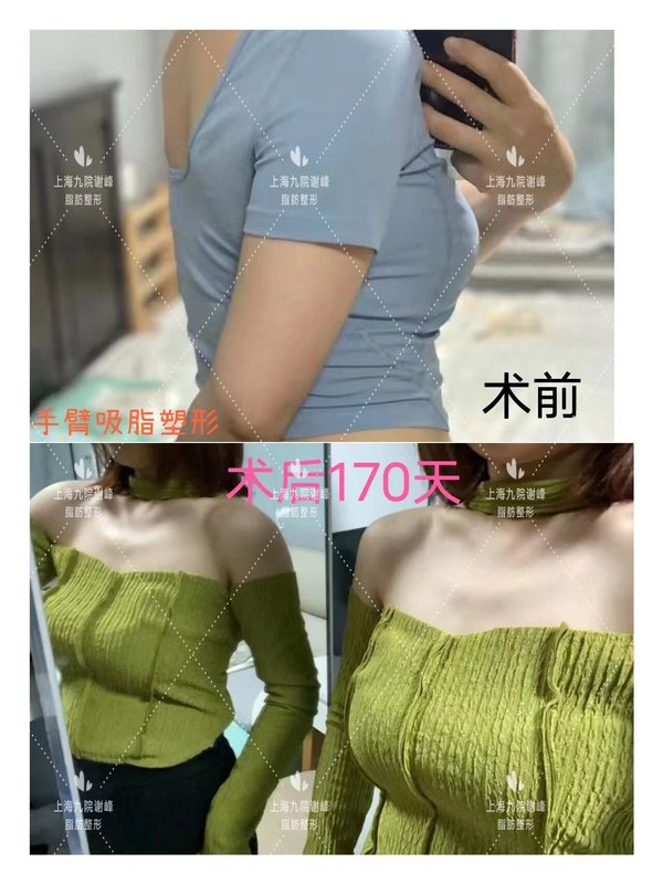 圖文圖片