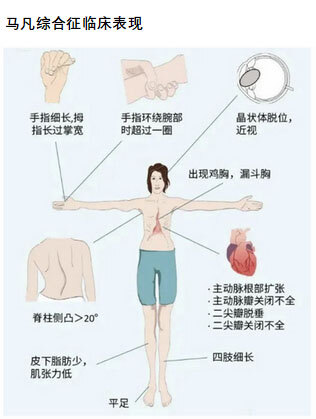 圖文圖片