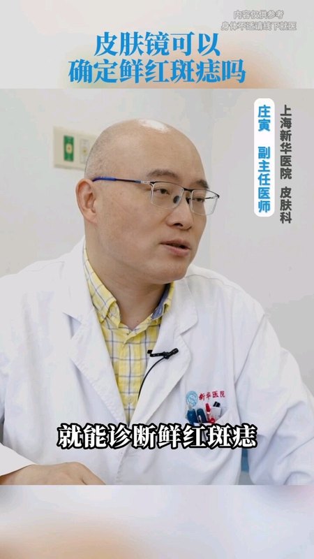 皮肤镜可以确定鲜红斑痣吗？