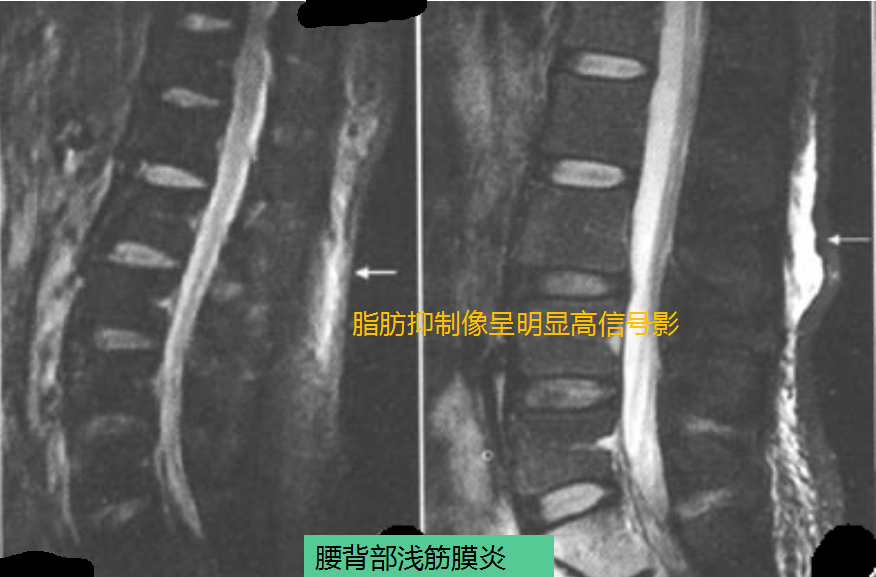 圖文圖片