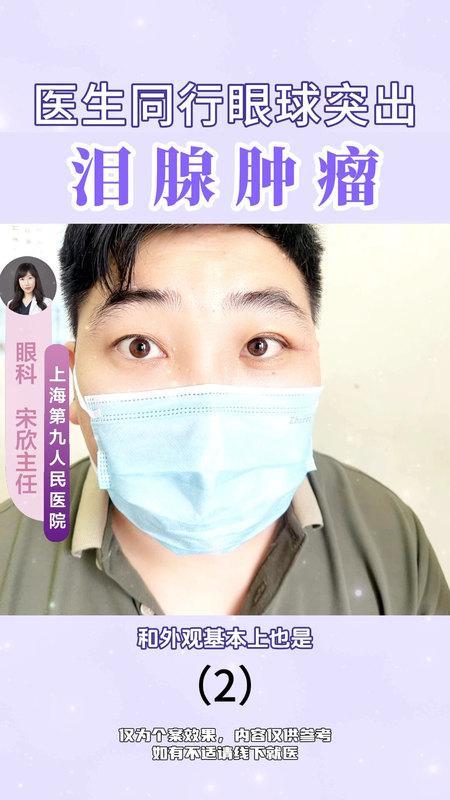 視頻封面