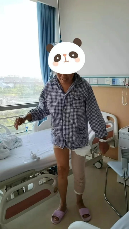 全膝关节置换术后4小时，竟然能下地踏步，关键还不疼？