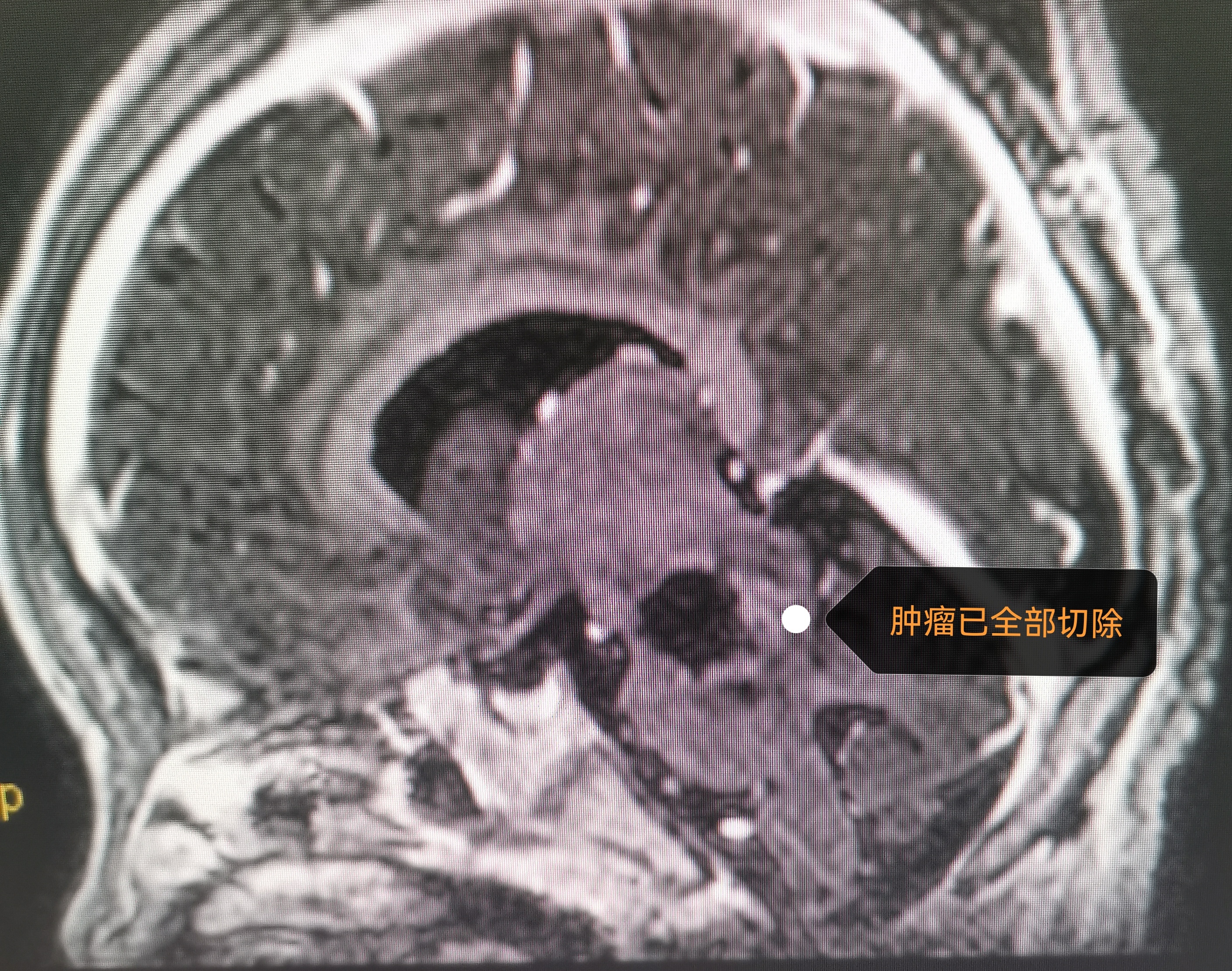 圖文圖片