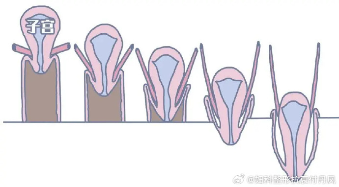 圖文圖片
