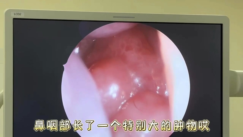 視頻封面