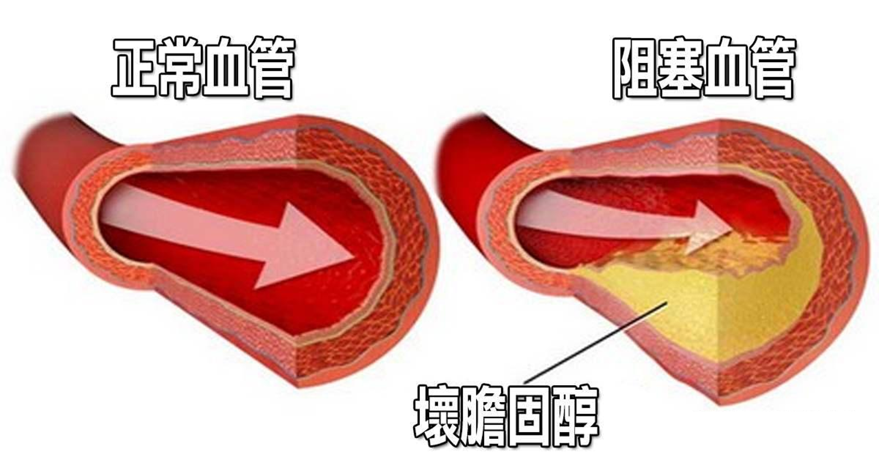圖文圖片