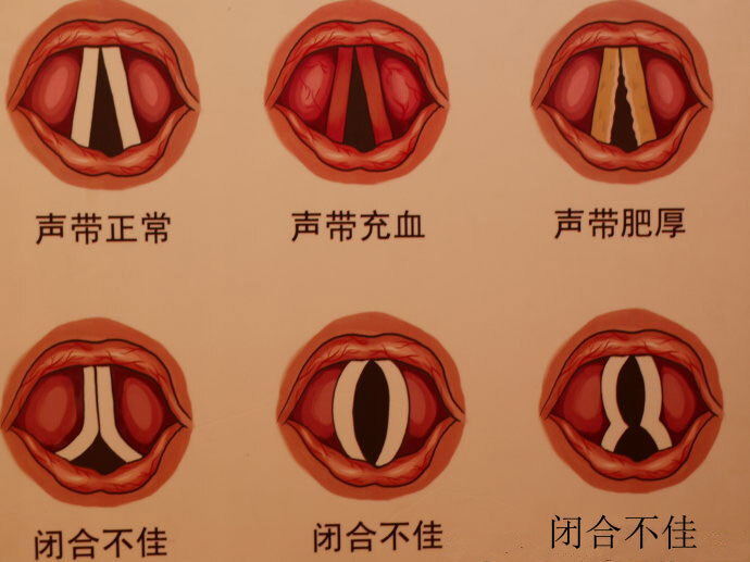圖文圖片