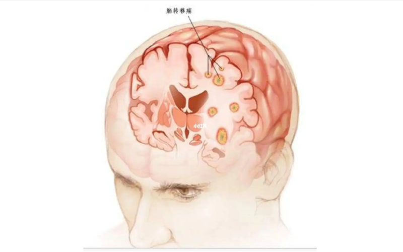 圖文圖片