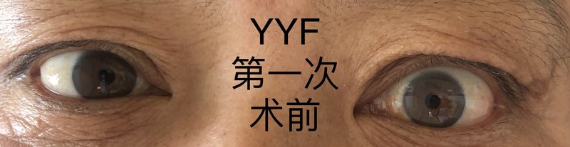 圖文圖片
