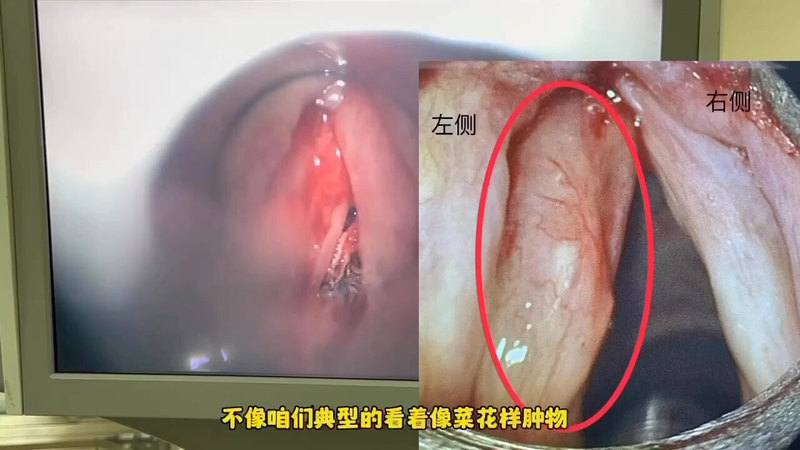 視頻封面