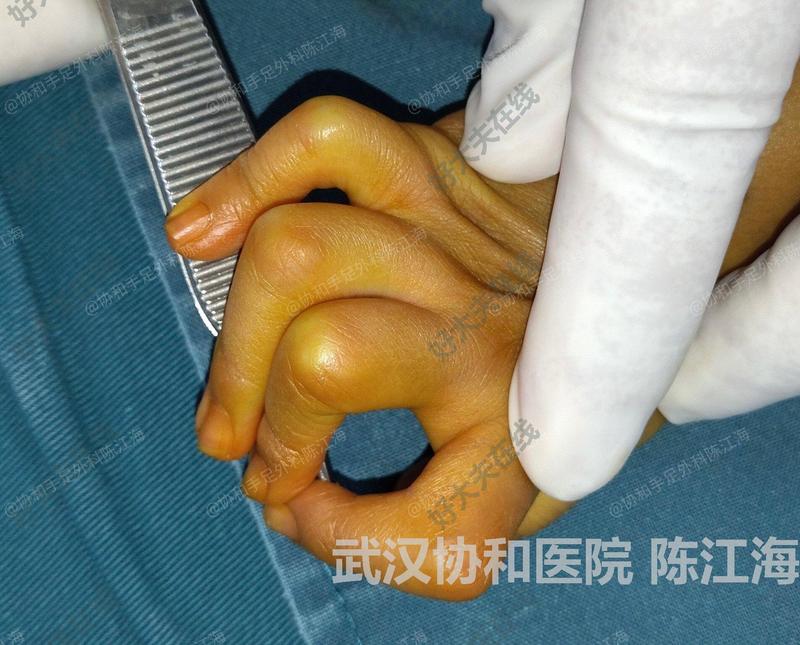 圖文圖片