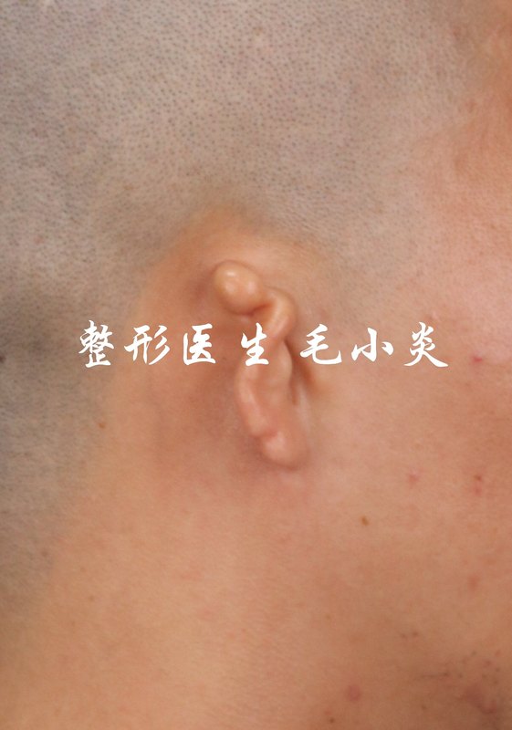 圖文圖片