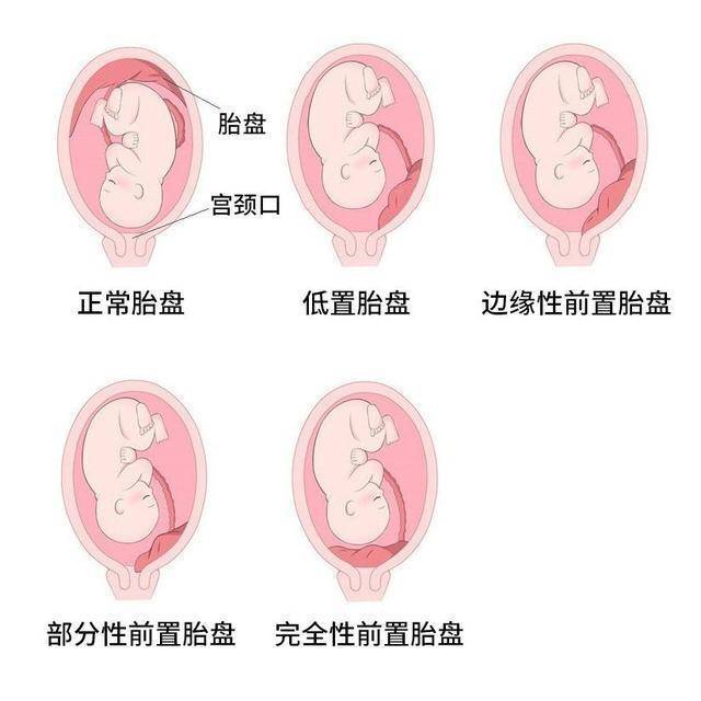 圖文圖片